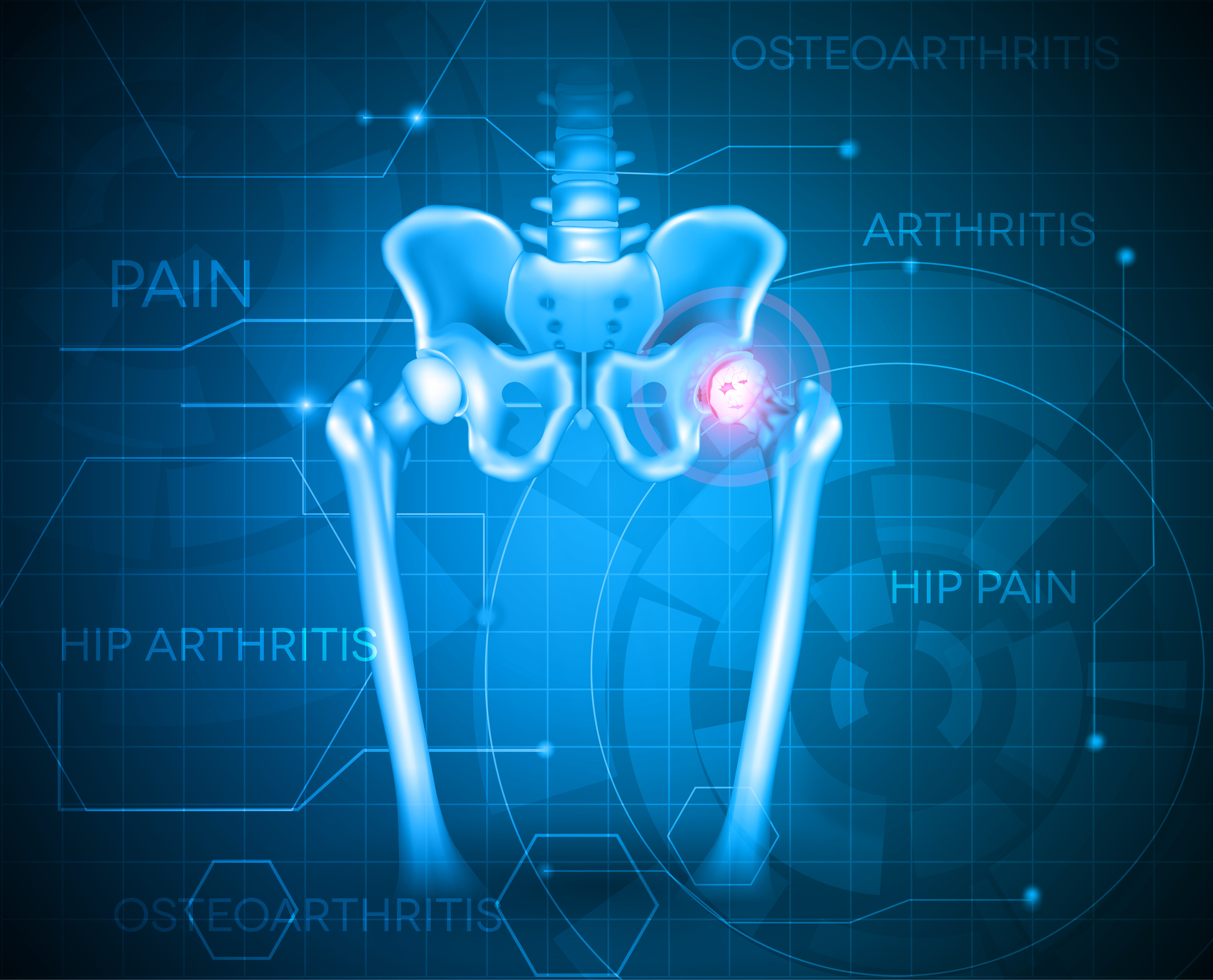 CU’s Unipolar Hip Prosthesis Receives Thailand’s First International Certification for All Production Stages
