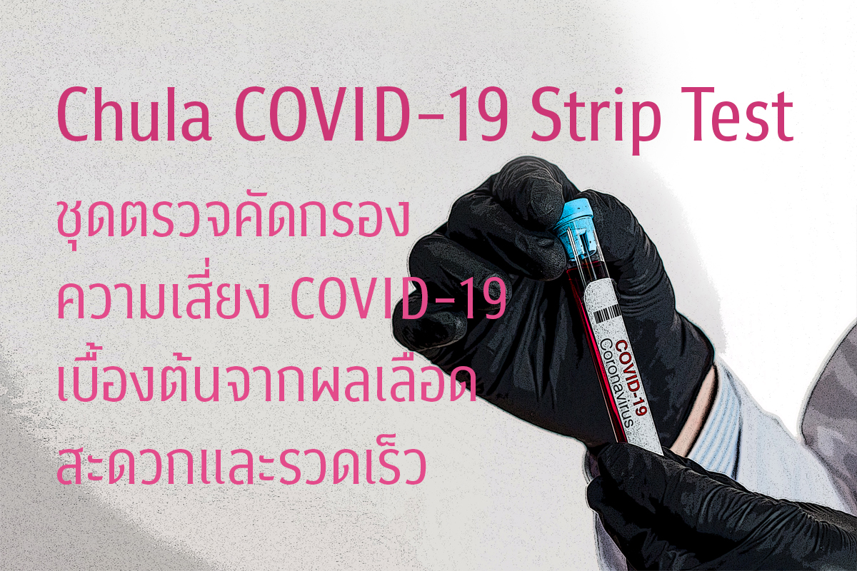 Chula COVID-19 Strip Test ชุดตรวจคัดกรองความเสี่ยง COVID-19 เบื้องต้นจากผลเลือด สะดวกและรวดเร็ว