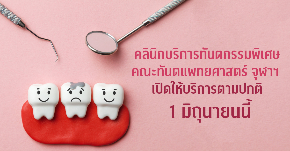 คลินิกบริการทันตกรรมพิเศษ คณะทันตแพทยศาสตร์ จุฬาฯ เปิดให้บริการตามปกติ 1 มิถุนายนนี้