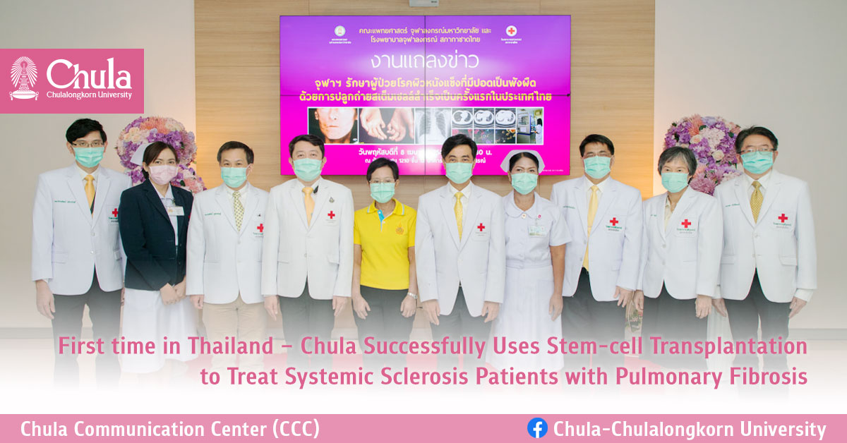 First time in Thailand – Chula Successfully Uses Stem-cell Transplantation to Treat Systemic Sclerosis Patients with Pulmonary Fibrosis