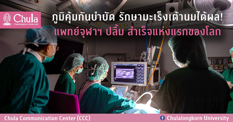 ภูมิคุ้มกันบำบัด รักษามะเร็งเต้านมได้ผล! แพทย์จุฬาฯ ปลื้ม สำเร็จแห่งแรกของโลก