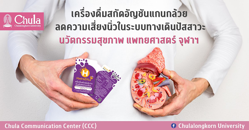 เครื่องดื่ม “สกัดอัญชัน แกนกล้วย” ลดความเสี่ยงนิ่วในกระเพาะปัสสาวะ นวัตกรรมสุขภาพ แพทยศาสตร์ จุฬาฯ