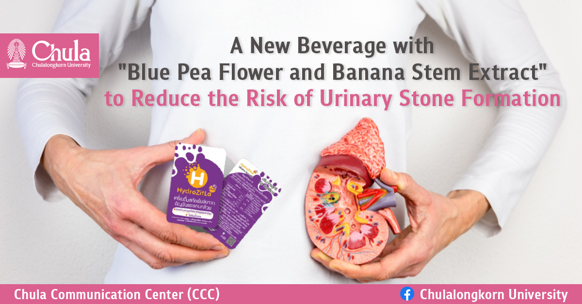 “Blue Pea Flower and Banana Stem Extract” Beverage to Reduce the Risk of Urinary Stone Formation  — A Medical Innovation from MED – CU