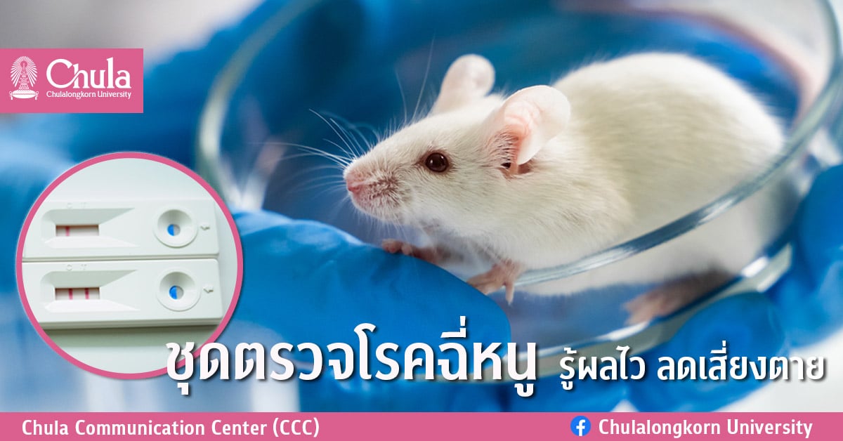 ชุดตรวจโรคฉี่หนู รู้ผลไว ลดเสี่ยงตาย