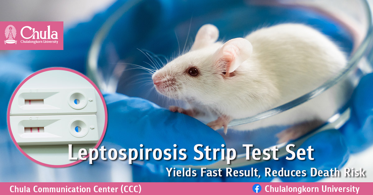 Leptospirosis Strip Test Set – Yields Fast Result, Reduces Death Risk