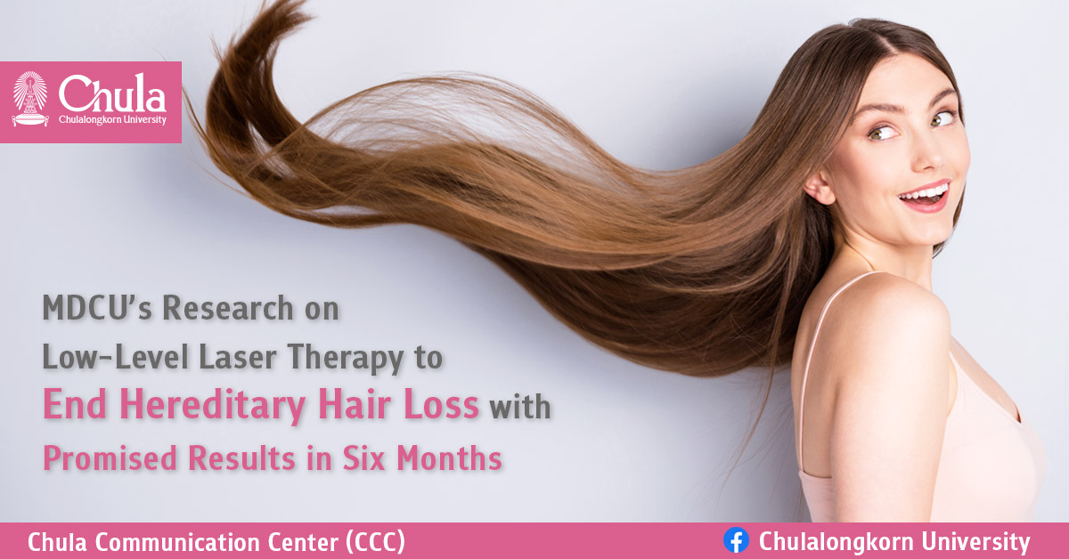 MDCU’s Research on Low-Level Laser Therapy to End Hereditary Hair Loss with Promised Results in Six Months