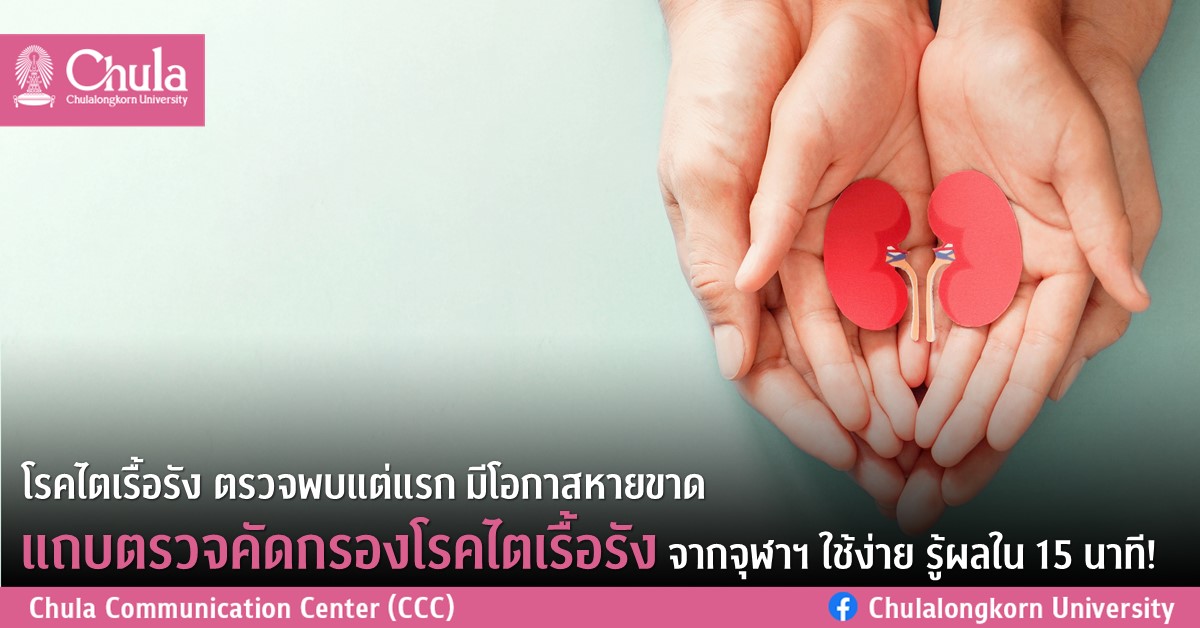 โรคไตเรื้อรัง ตรวจพบแต่แรก มีโอกาสหายขาด แถบตรวจคัดกรองโรคไตเรื้อรัง จากจุฬา ฯ ใช้ง่าย รู้ผลใน 15 นาที!