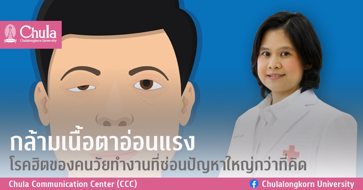 กล้ามเนื้อตาอ่อนแรง โรคฮิตของคนวัยทำงานที่ซ่อนปัญหาใหญ่กว่าที่คิด