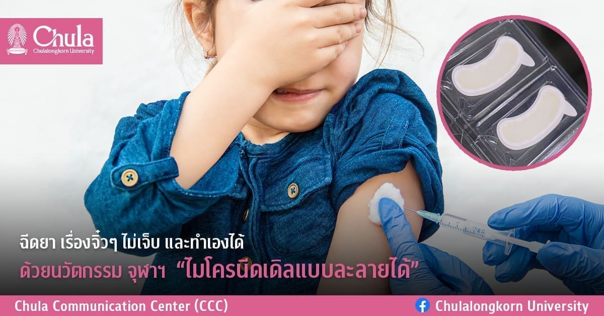 ฉีดยา เรื่องจิ๋วๆ ไม่เจ็บ และทำเองได้ ด้วยนวัตกรรม จุฬาฯ “ไมโครนีดเดิลแบบละลายได้”