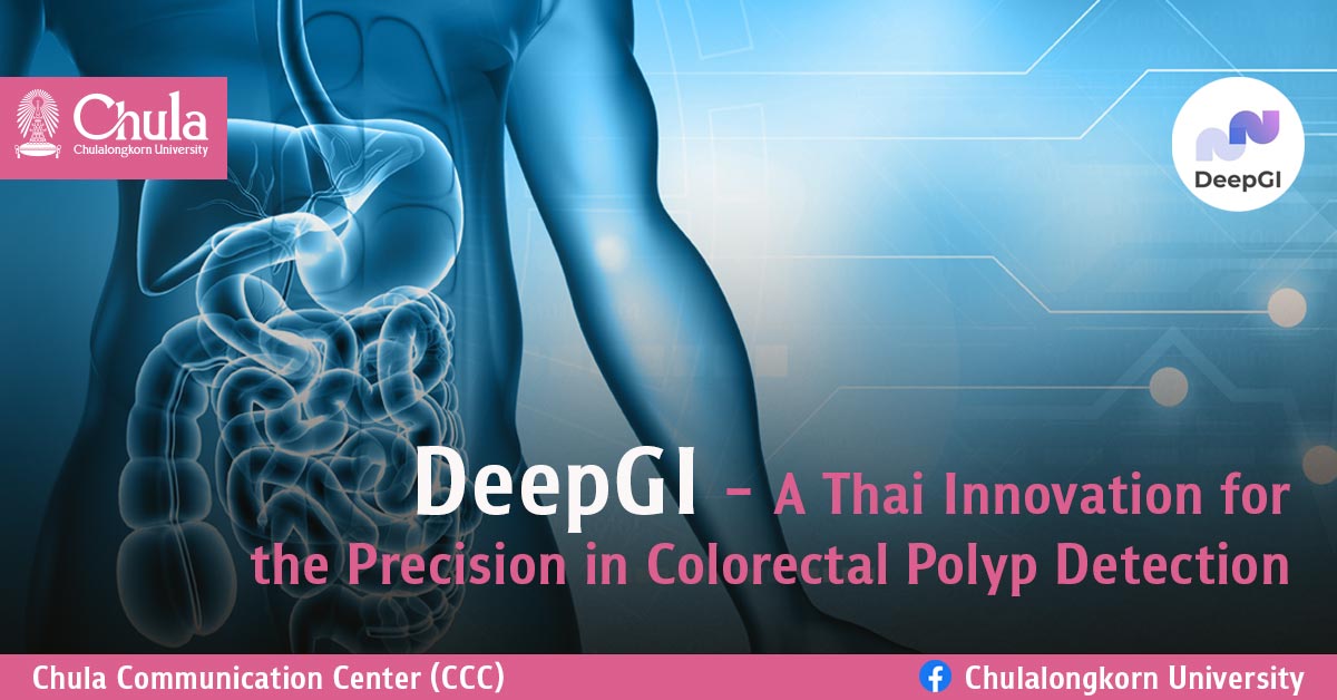 DeepGI – A Thai Innovation for the Precision in Colorectal Polyp Detection
