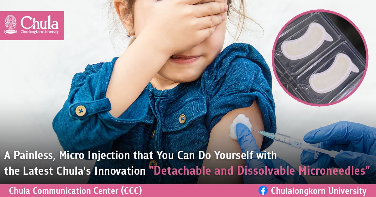 A Painless, Micro Injection that You Can Do Yourself with the Latest Chula’s Innovation “Detachable and Dissolvable Microneedles” 