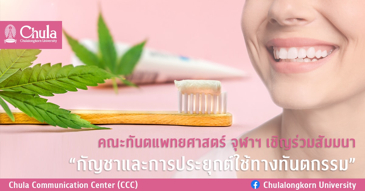 คณะทันตแพทยศาสตร์ จุฬาฯ เชิญร่วมสัมมนา “กัญชาและการประยุกต์ใช้ทางทันตกรรม”