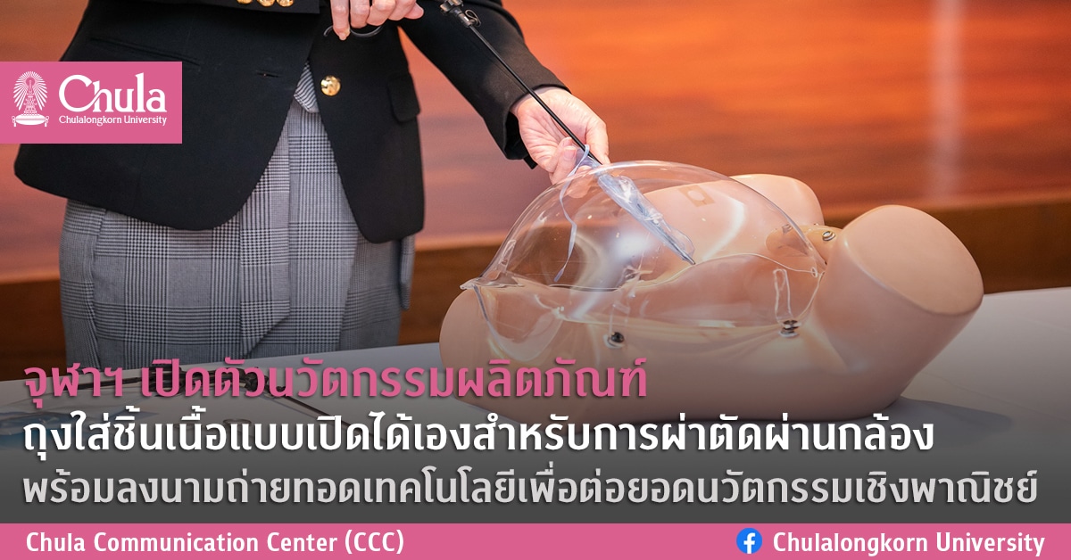 จุฬาฯ เปิดตัวนวัตกรรมผลิตภัณฑ์ ถุงใส่ชิ้นเนื้อแบบเปิดได้เองสำหรับการผ่าตัดผ่านกล้อง พร้อมลงนามถ่ายทอดเทคโนโลยีเพื่อต่อยอดนวัตกรรมเชิงพาณิชย์