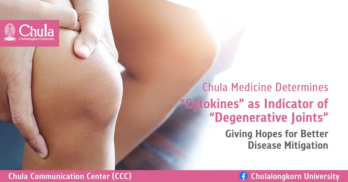 Chula Medicine Determines “Cytokines” as Indicator of “Degenerative Joints” Giving Hopes for Better Disease Mitigation
