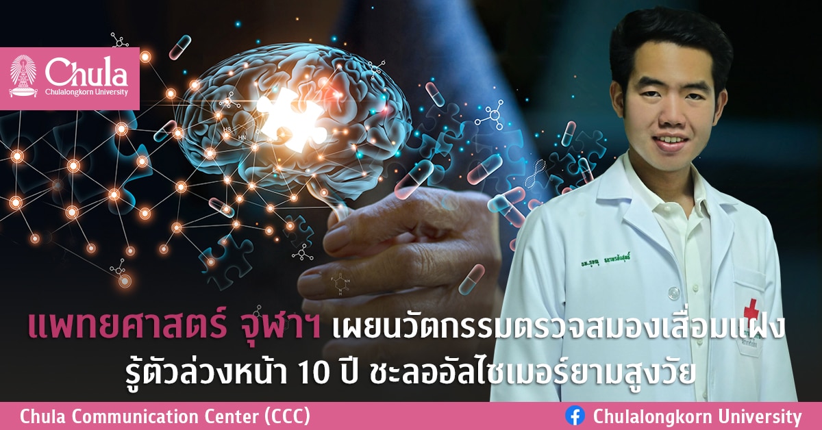 แพทยศาสตร์ จุฬาฯ เผยนวัตกรรมตรวจสมองเสื่อมแฝง รู้ตัวล่วงหน้า 10 ปี ชะลออัลไซเมอร์ยามสูงวัย