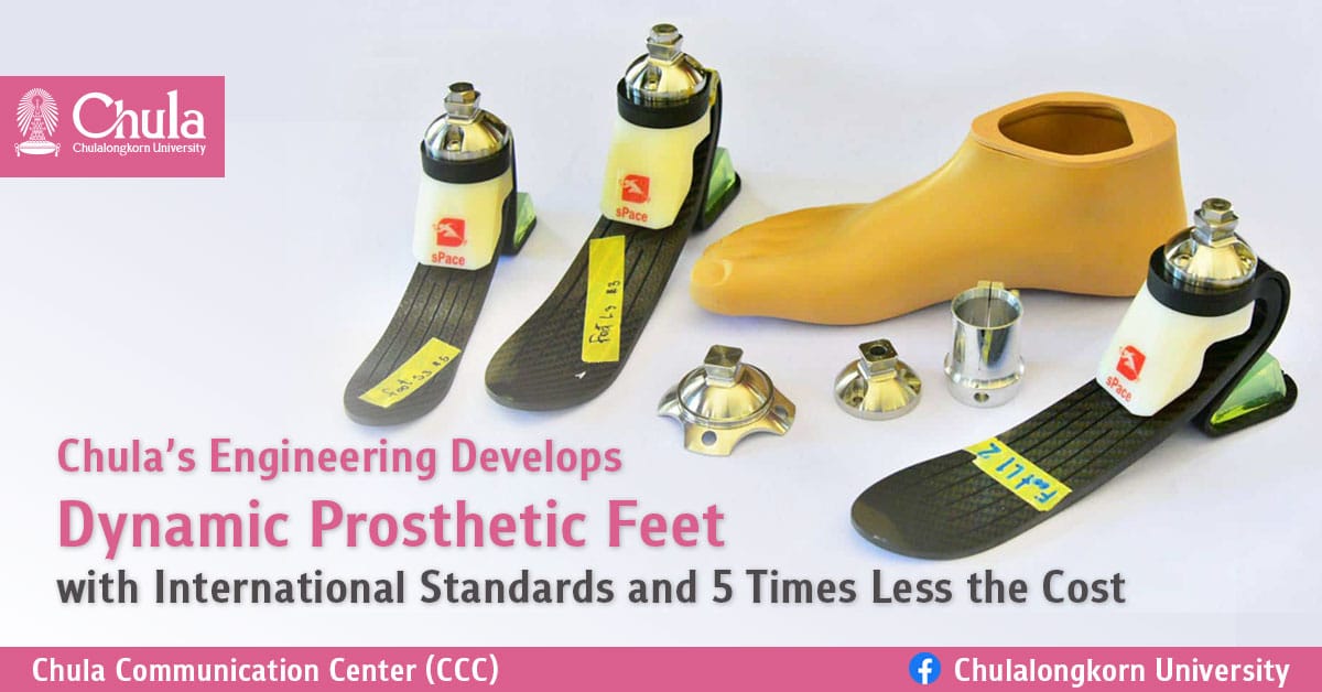 Chula’s Engineering Develops Dynamic Prosthetic Feet with International Standards and 5 Times Less the Cost