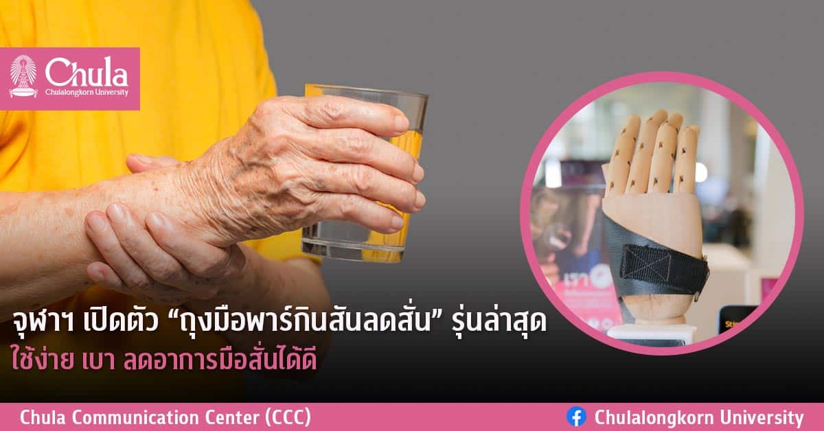 จุฬาฯ เปิดตัวถุงมือพาร์กินสันลดสั่นรุ่นล่าสุด ใช้ง่ายเบา ลดอาการมือสั่นได้ดี