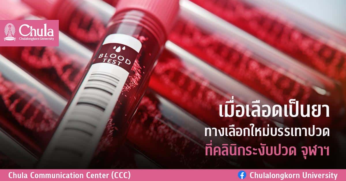 เมื่อเลือดเป็นยา ทางเลือกใหม่บรรเทาปวด ที่คลินิกระงับปวด จุฬาฯ