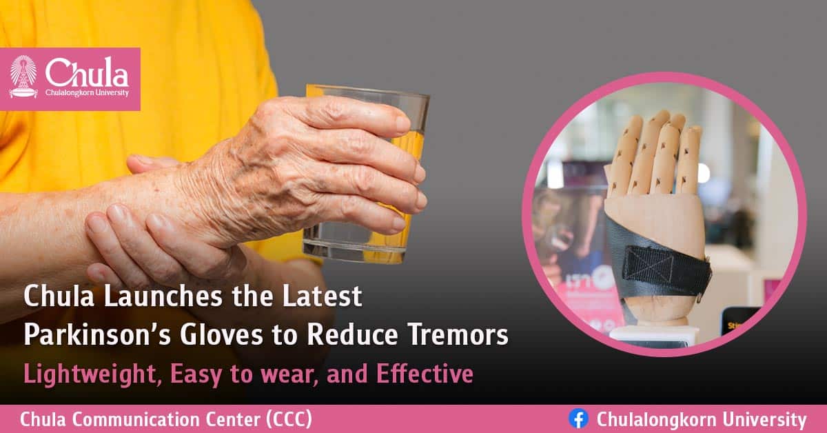 Chula Launches the Latest Parkinson’s Gloves to Reduce Tremors