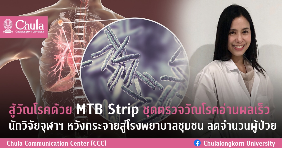 สู้วัณโรคด้วย MTB Strip ชุดตรวจวัณโรคอ่านผลเร็ว นักวิจัยจุฬาฯ หวังกระจายสู่โรงพยาบาลชุมชน ลดจำนวนผู้ป่วย