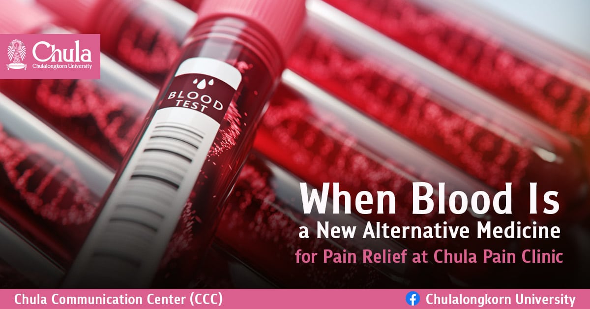 When Blood Is a New Alternative Medicine for Pain Relief at Chula Pain Clinic