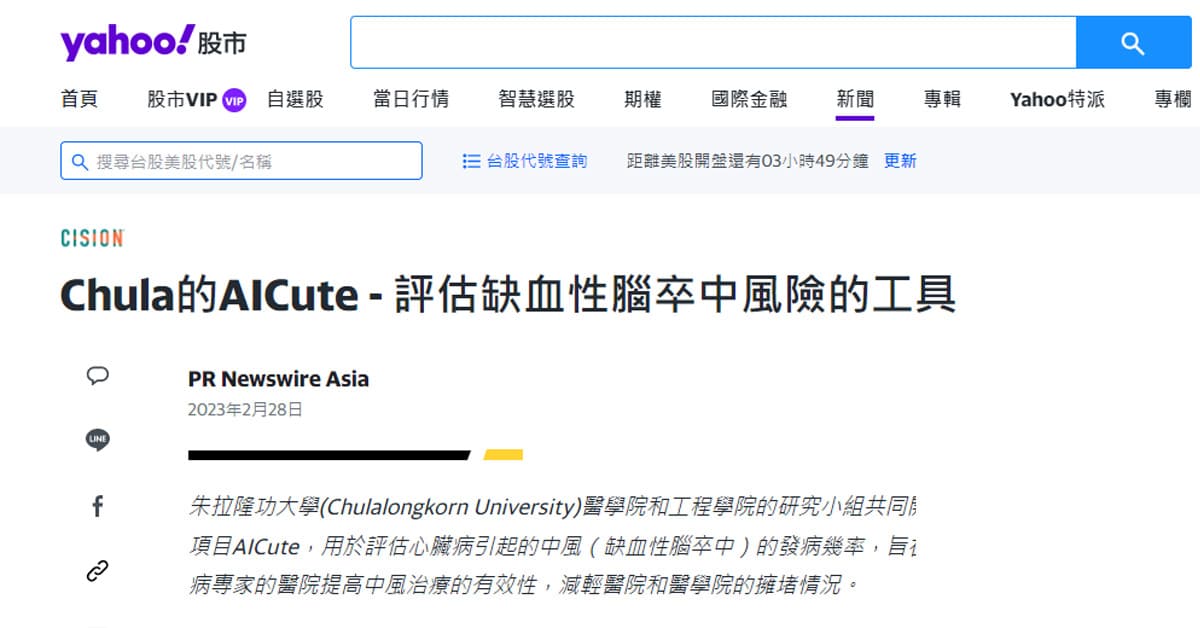 Chula的AICute – 評估缺血性腦卒中風險的工具