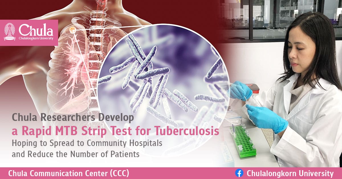 Chula Researchers Develop a Rapid MTB Strip Test for Tuberculosis Hoping to Spread to Community Hospitals and Reduce the Number of Patients