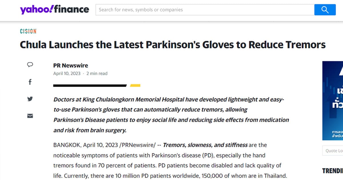 Chula Launches the Latest Parkinson’s Gloves to Reduce Tremors