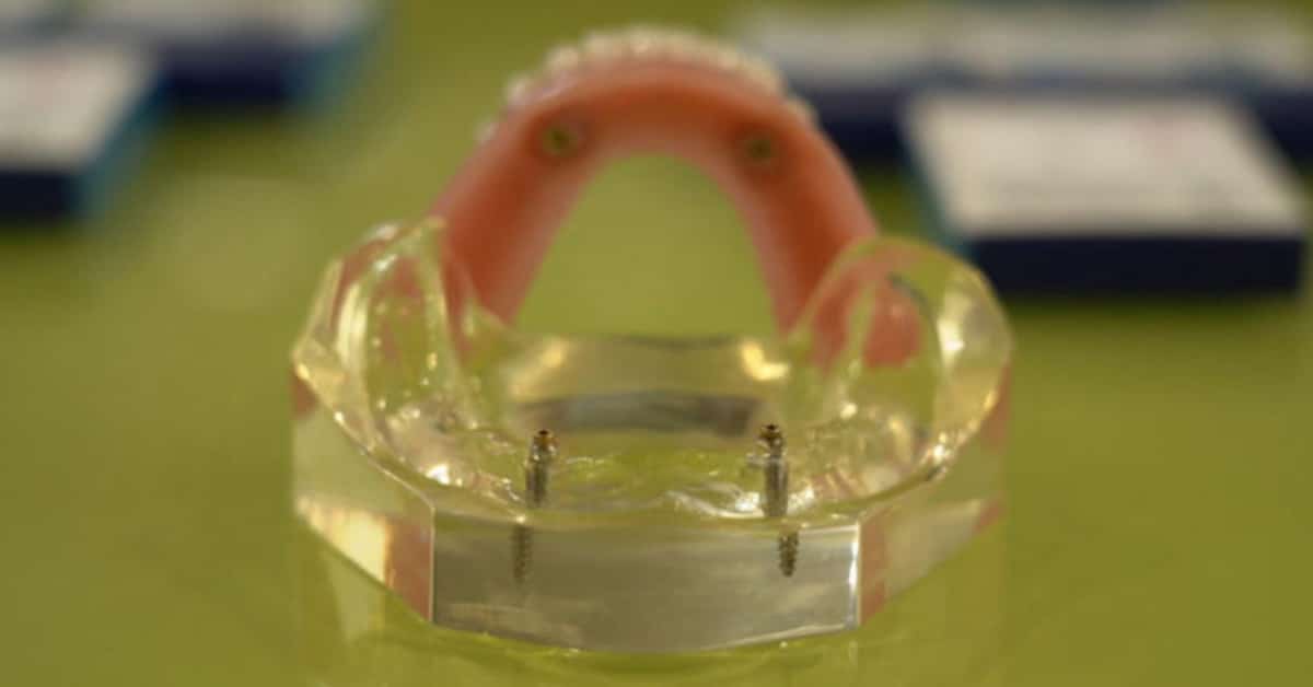 Bills Cut with Thai Artificial Tooth Roots
