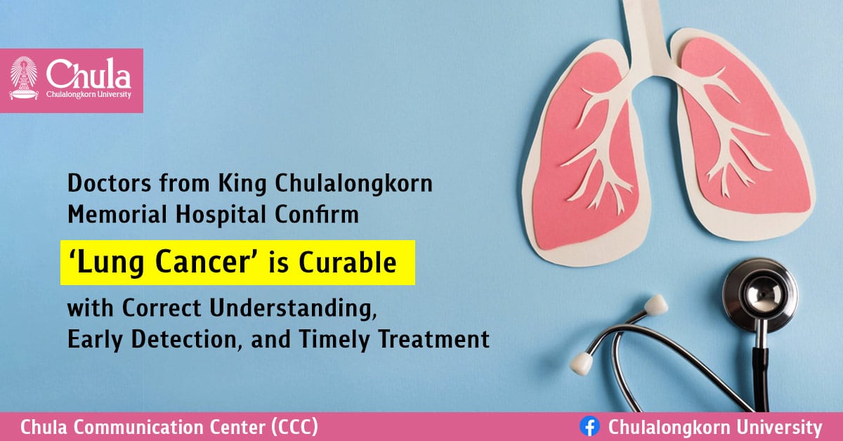 Doctors from King Chulalongkorn Memorial Hospital Confirm ‘Lung Cancer’ is Curable with Correct Understanding, Early Detection, and Timely Treatment