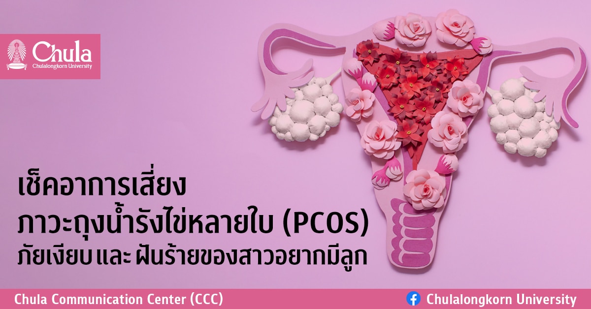 ประจำเดือนไม่ปกติ ผมร่วง สิวเยอะ อ้วน เช็คอาการเสี่ยงภาวะถุงน้ำรังไข่หลายใบ (PCOS) ภัยเงียบและฝันร้ายของสาวอยากมีลูก
