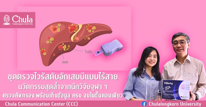 ชุดตรวจไวรัสตับอักเสบบีแบบไร้สาย นวัตกรรมสุดล้ำจากนักวิจัยจุฬา ฯ ตรวจคัดกรอง พร้อมเก็บข้อมูล ครบ จบในขั้นตอนเดียว