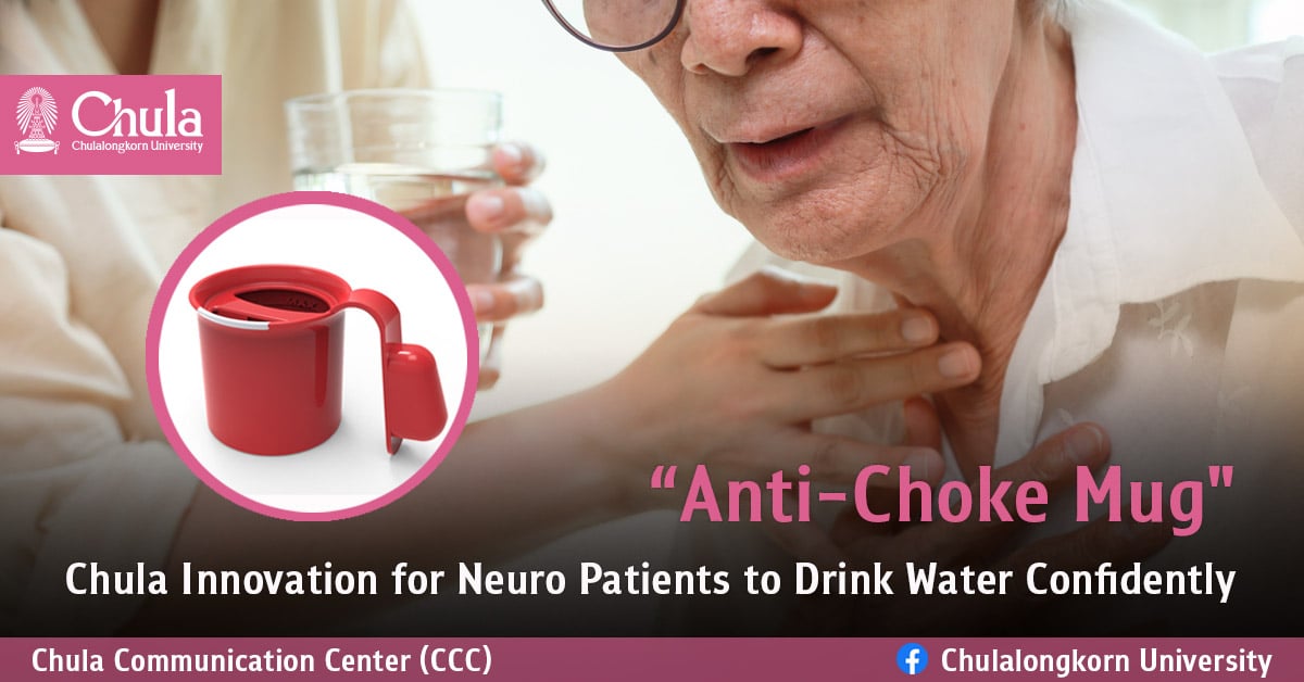 “Anti-Choke Mug” – Chula Innovation for Neuro Patients to Drink Water Confidently
