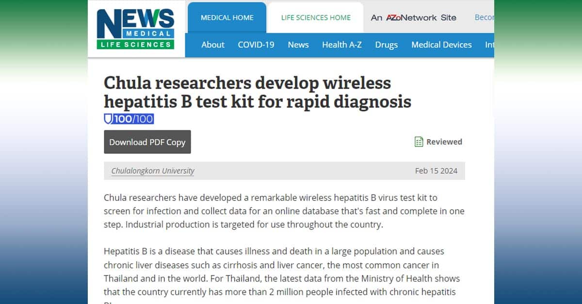 NewsMedical: Chula Researchers Develop Wireless Hepatitis B Test Kit for Rapid Diagnosis