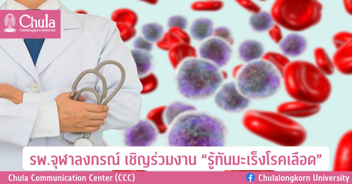 รพ.จุฬาลงกรณ์ เชิญร่วมงาน “รู้ทันมะเร็งโรคเลือด”