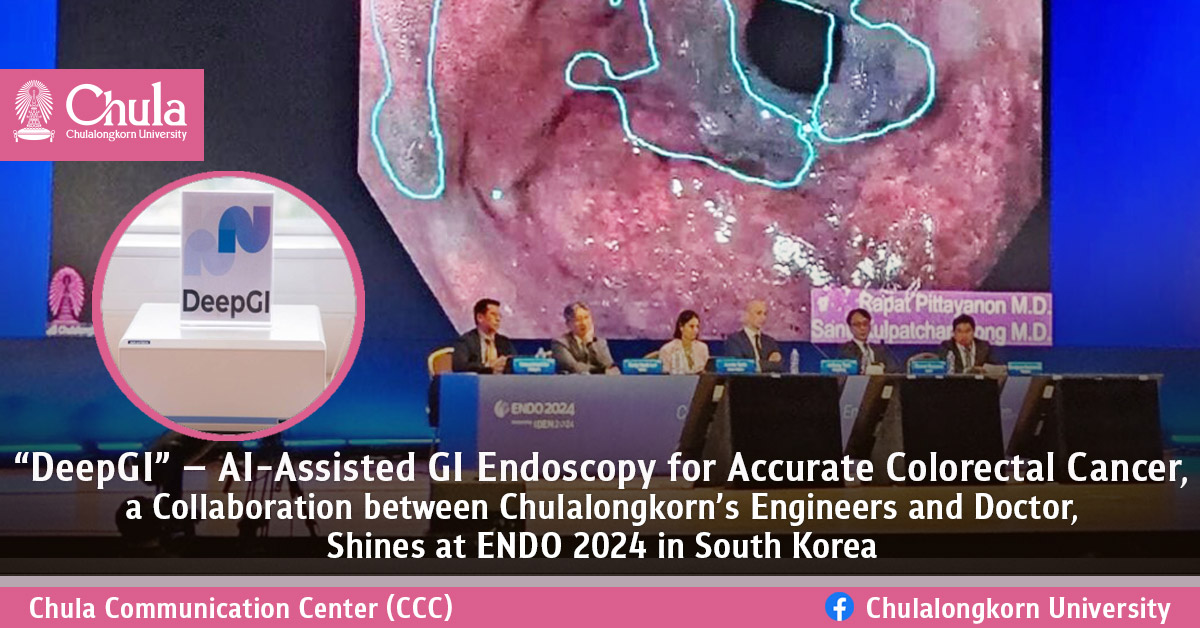 ��DeepGI�� �� AI-Assisted GI Endoscopy for Accurate Colorectal Cancer, a Collaboration between Chulalongkorn��s Engineers and Doctor, Shines at ENDO 2024 in South Korea?