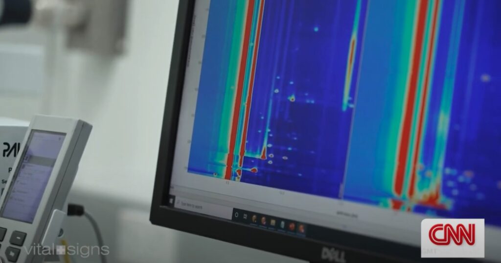 Global Media Giant CNN Highlights Thai Researchers�� Groundbreaking Innovation in Stress Detection Through Sweat Analysis