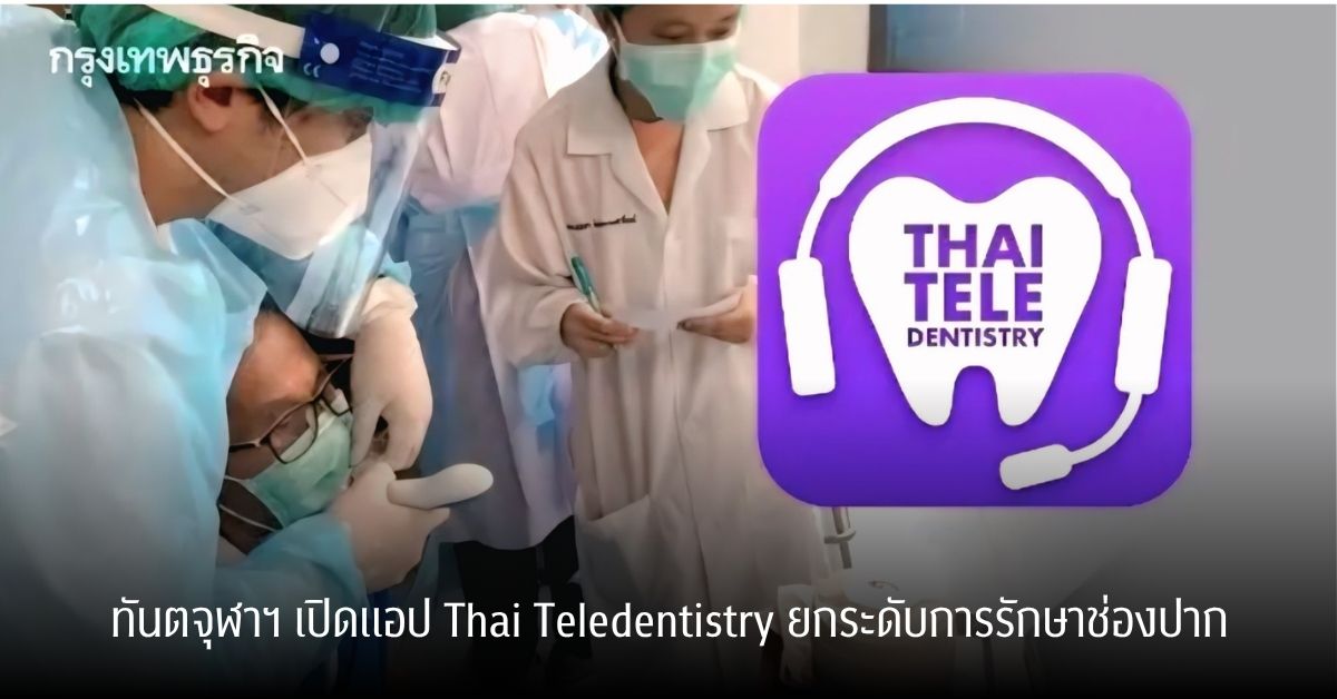 ทันตแพทย์ จุฬาฯ เปิดแอป Thai Teledentistry ยกระดับการรักษาช่องปาก