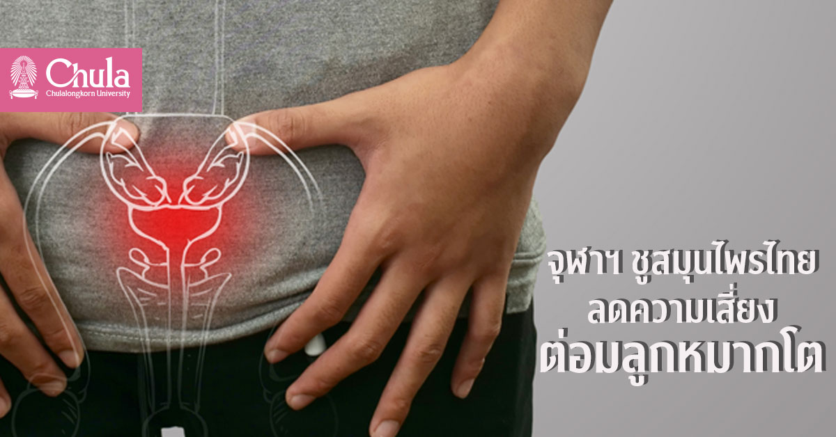 สมุนไพรไทย “พืชสกุลพลับพลึง – กระชายดำ” ทางเลือกใหม่ยับยั้งความเสี่ยงต่อมลูกหมากโต จากทีมวิจัยจุฬาฯ
