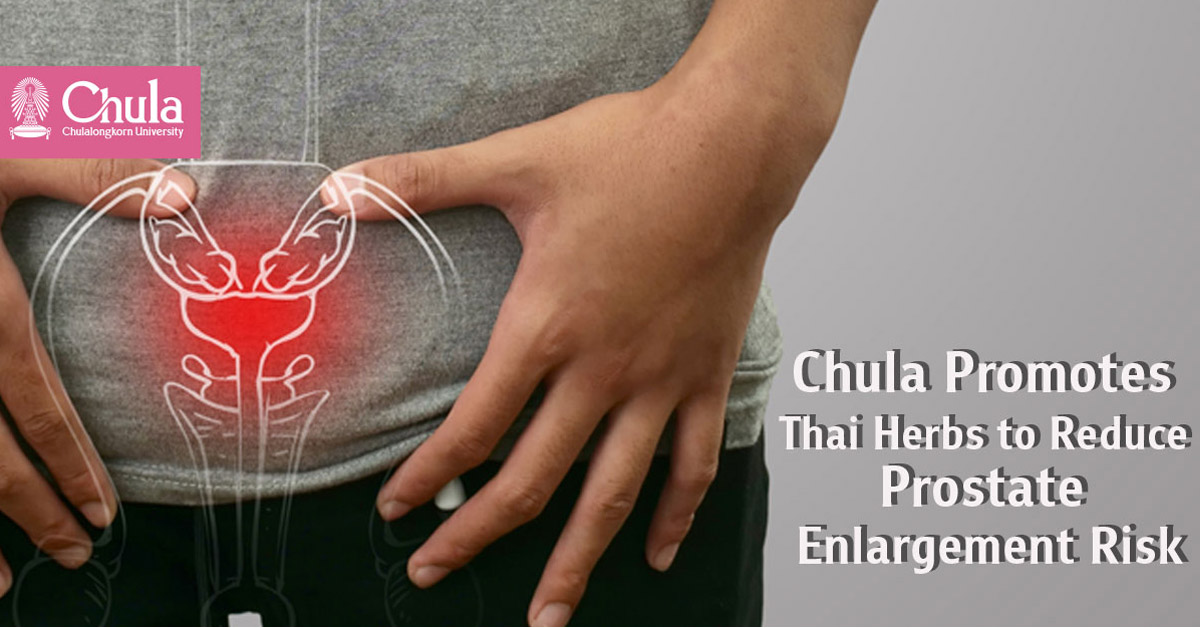 Thai Herbs “Crinum Plants – Black Ginger”: A New Alternative to Reduce the Risk of Prostate Enlargement by Chula Research Team