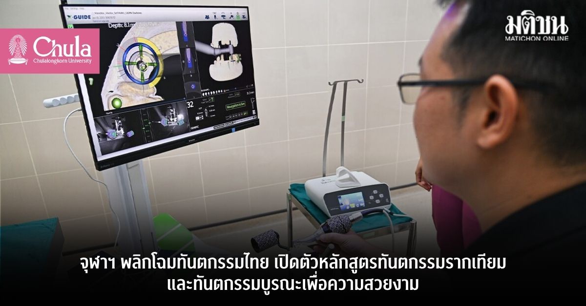 จุฬาฯ พลิกโฉมทันตกรรมไทย เปิดตัวหลักสูตรทันตกรรมรากเทียมและทันตกรรมบูรณะเพื่อความสวยงาม