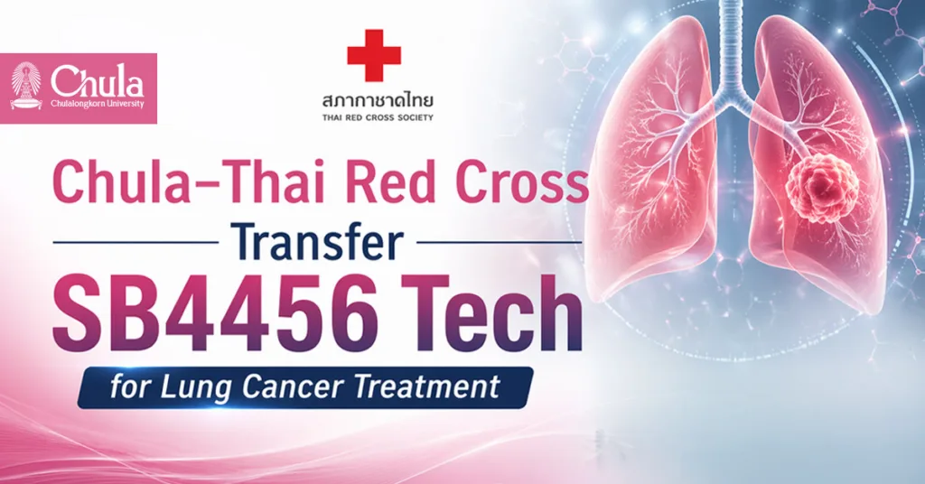 Chula–Thai Red Cross Transfer SB4456 Tech for Lung Cancer Treatment