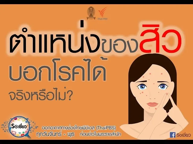 Soเชี่ยว EP61 ตำแหน่งของสิวบอกโรคได้ จริงหรือไม่