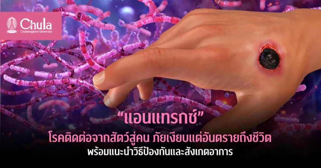 “แอนแทรกซ์” โรคติดต่อจากสัตว์สู่คน ภัยเงียบที่อันตรายถึงชีวิต อาจารย์จุฬาฯ แนะวิธีป้องกันและสังเกตอาการ