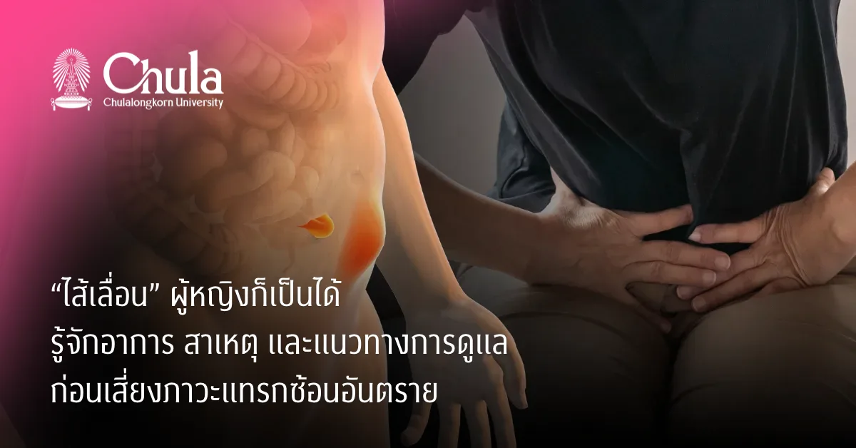“ไส้เลื่อน” ผู้หญิงก็เป็นได้ รู้จักอาการ สาเหตุ และแนวทางการดูแล ก่อนเสี่ยงภาวะแทรกซ้อนอันตราย