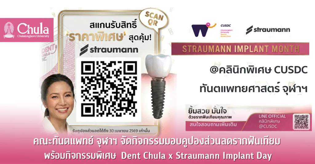คณะทันตแพทย์ จุฬาฯ จัดกิจกรรมมอบคูปองส่วนลดรากฟันเทียม พร้อมกิจกรรมพิเศษ  Dent Chula x Straumann Implant Day