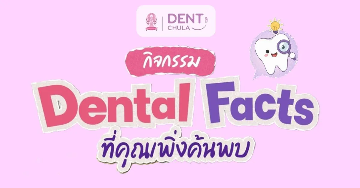 คณะทันตแพทยศาสตร์ จุฬาฯ ขอเชิญร่วมกิจกรรม “Dental Facts ที่คุณเพิ่งค้นพบ”