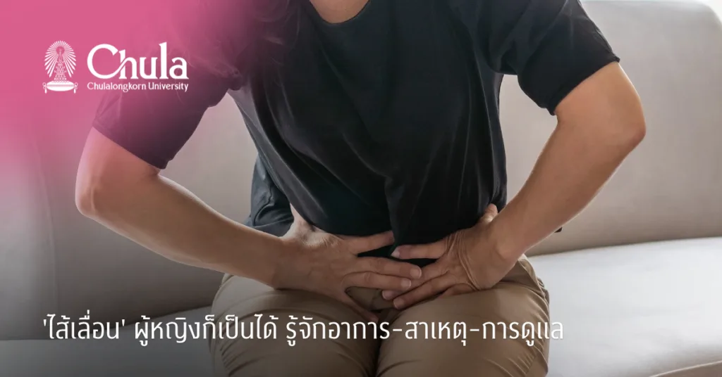 ‘ไส้เลื่อน’ ผู้หญิงก็เป็นได้ รู้จักอาการ-สาเหตุ-การดูแล