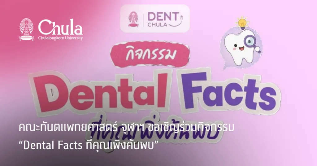 คณะทันตแพทยศาสตร์ จุฬาฯ ขอเชิญร่วมกิจกรรม “Dental Facts ที่คุณเพิ่งค้นพบ”